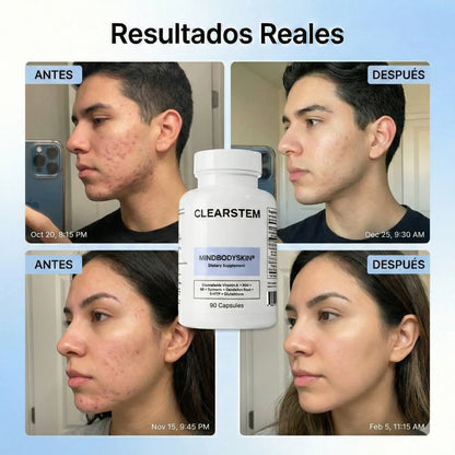 CLEARSTEM - CAPSULA PARA EL ACNE.