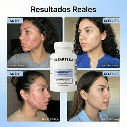 CLEARSTEM - CAPSULA PARA EL ACNE.