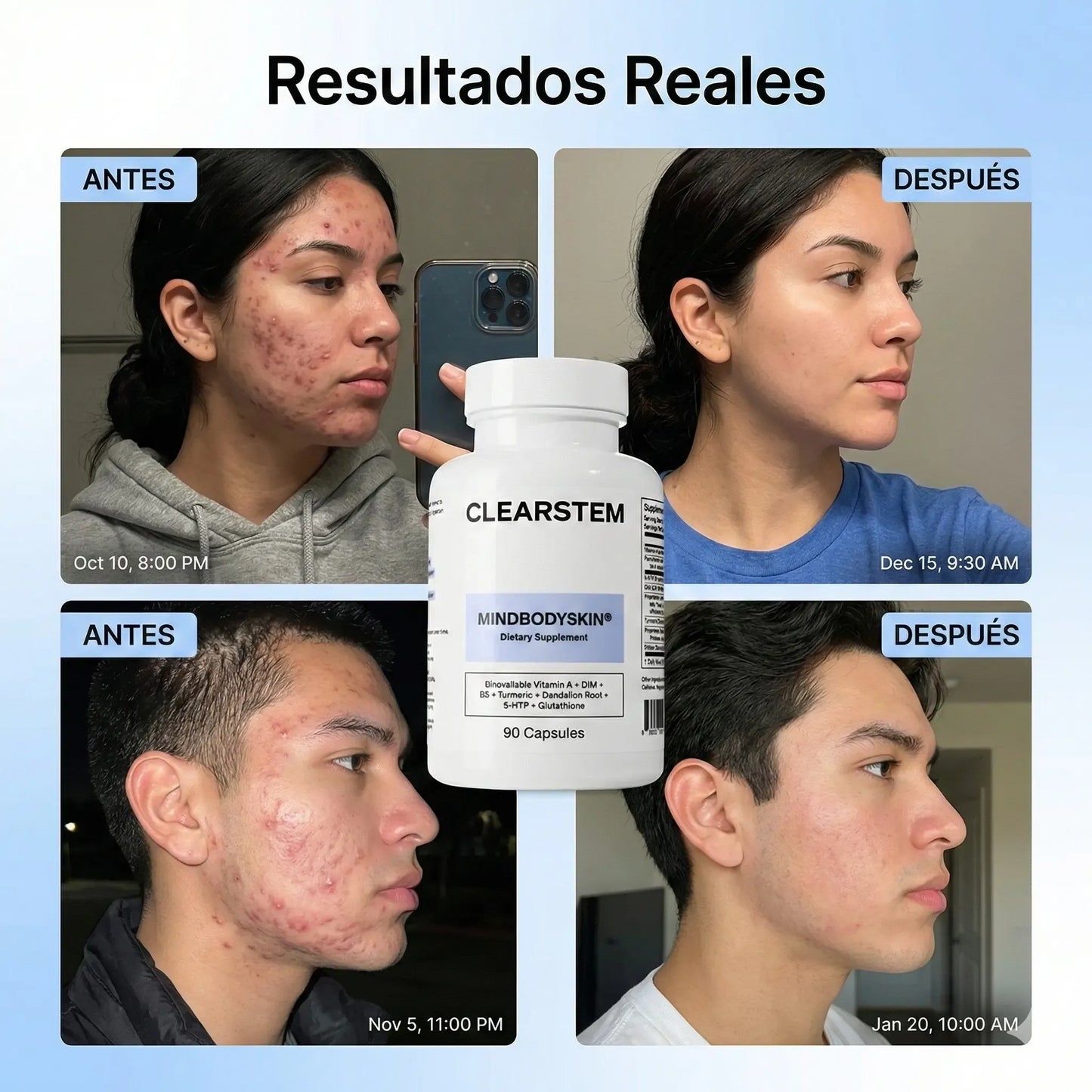 CLEARSTEM - CAPSULA PARA EL ACNE.